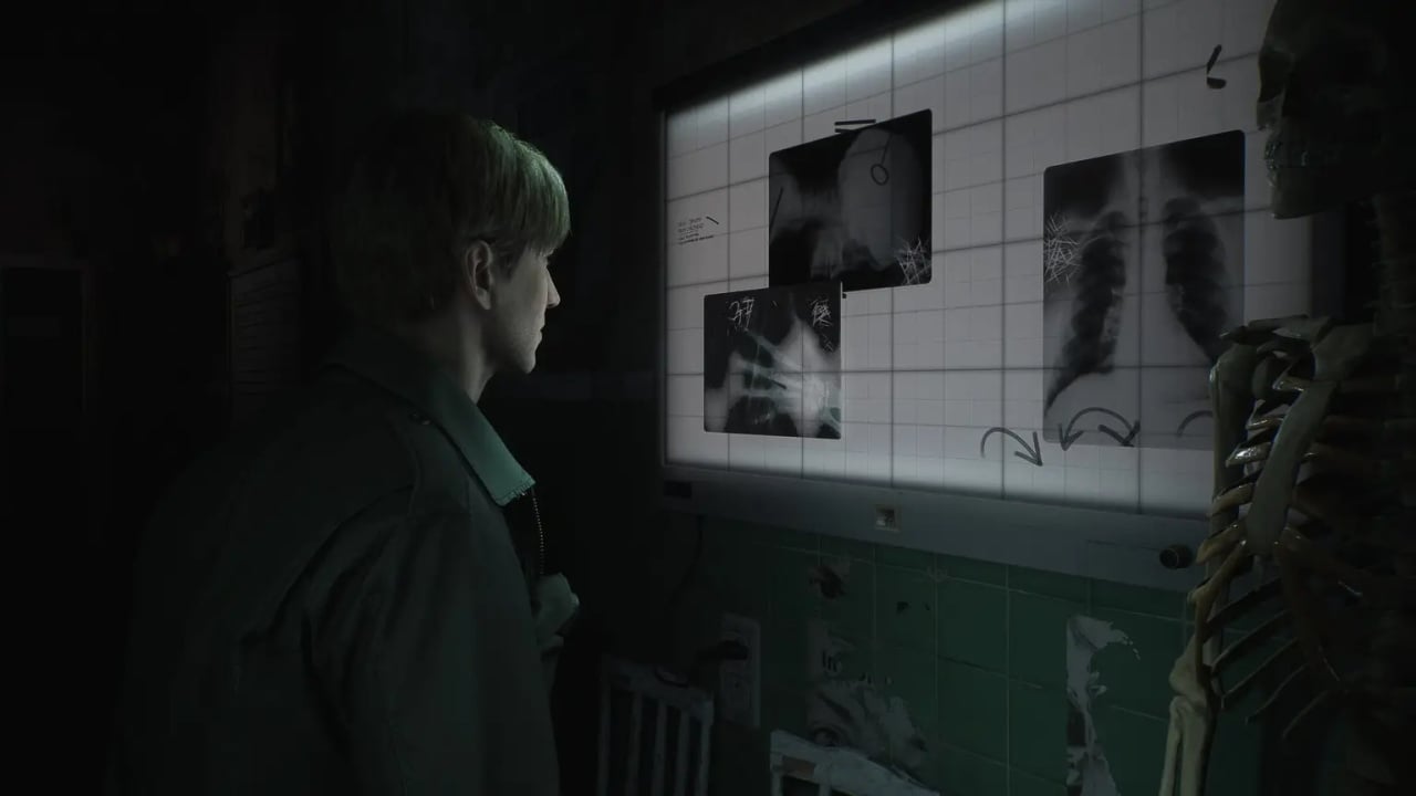 silent hill 2 remake screenshot 2.large